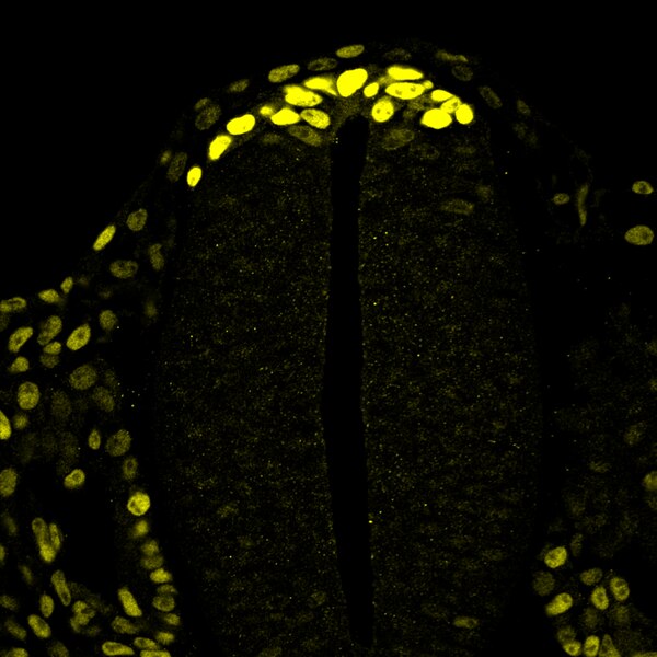 Immunofluorescence image of a cryosectioned chicken embryo trunk region labeled with DSHB antibody DA1D1 against Sox-9. Image Credit: Cathy Danesin (Inserm) and Eric Theveneau (CNRS).